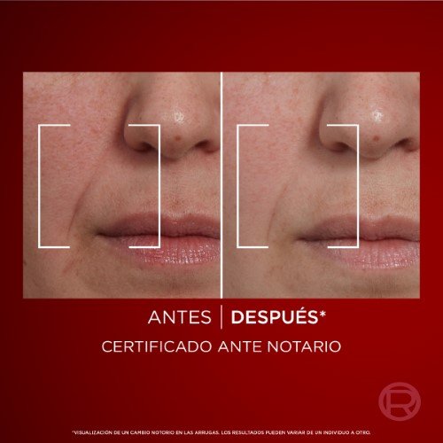 Revitalift Laser 3 Personalizado